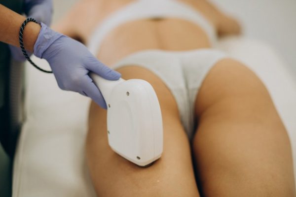 Depilación Laser de Diodo y Sof